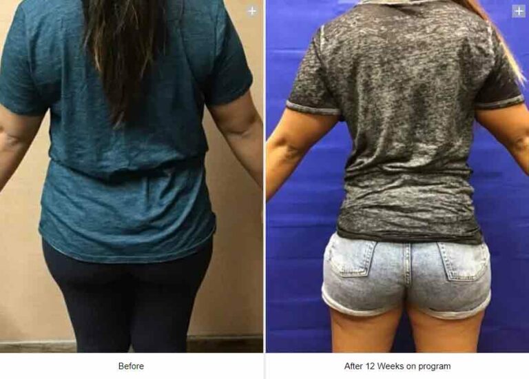 Medical Weight Loss Clients at LCS Medical Spa in Seguin, TX