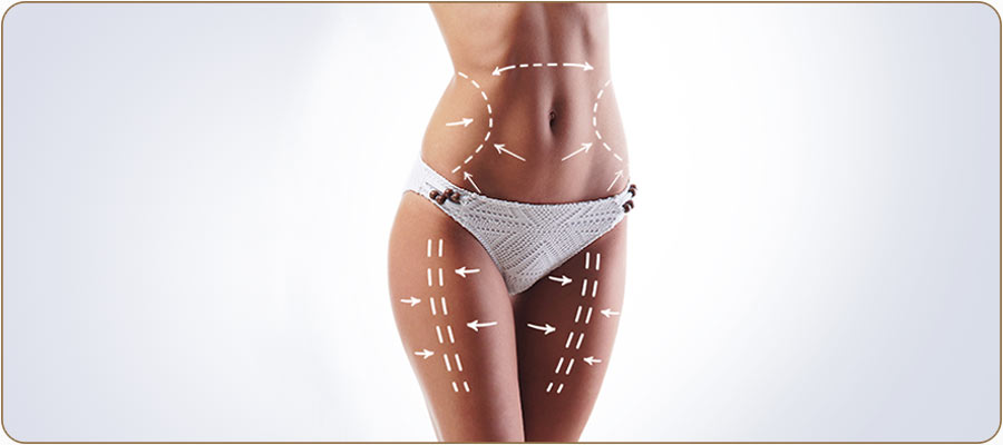 360 Liposuction at LCS Medical Spa Near Me in Seguin, TX