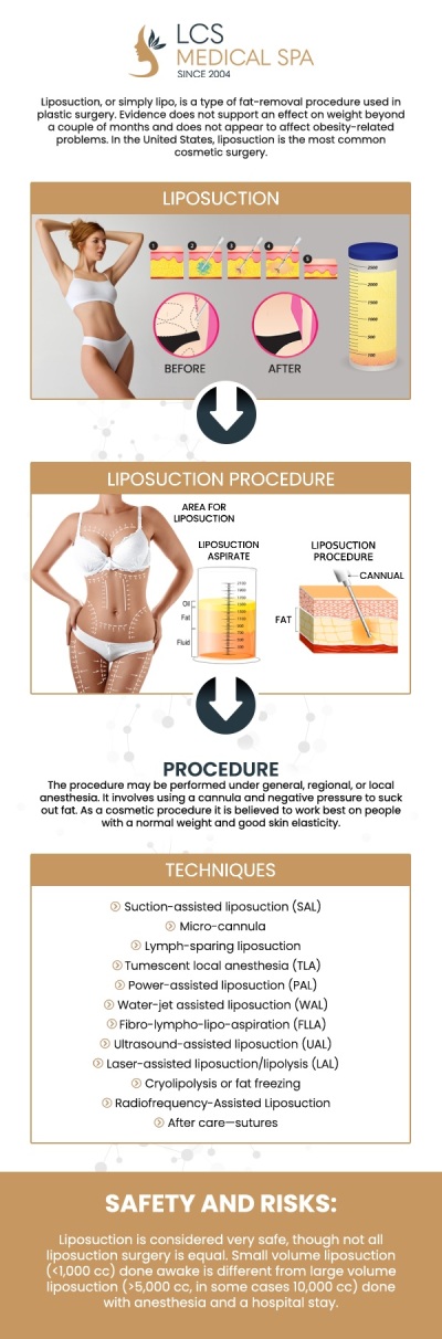 The cost of liposuction varies depending on the areas treated, the amount of fat removed, and the type of liposuction technique used. Liposuction in San Antonio typically ranges from $895 to $8,000 per area. At LCS Medical Spa, we offer personalized liposuction procedures that are designed to give you the best results within your budget. Dr. Melanie Carreon provides transparent pricing and works with you to create a treatment plan that fits your needs and goals. We’ll provide you with a detailed breakdown to help you make an informed decision. For more information, contact us or schedule an appointment online. We are located at 1199 E College St., Seguin, TX 78155. The cost of liposuction varies depending on the areas treated, the amount of fat removed, and the type of liposuction technique used. Liposuction in San Antonio typically ranges from $895 to $8,000 per area. At LCS Medical Spa, we offer personalized liposuction procedures that are designed to give you the best results within your budget. Dr. Melanie Carreon provides transparent pricing and works with you to create a treatment plan that fits your needs and goals. We’ll provide you with a detailed breakdown to help you make an informed decision. For more information, contact us or schedule an appointment online. We are located at 1199 E College St., Seguin, TX 78155.