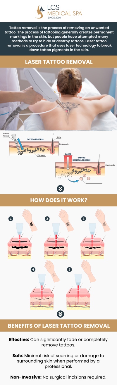 If you’re looking for an experienced laser tattoo removal specialist in San Antonio, Seguin, TX, Dr. Melanie Carreon, M.D., at LCS Medical Spa is here to help. Using advanced laser technology, Dr. Carreon provides safe, precise tattoo removal treatments that can effectively remove or lighten unwanted tattoos. With personalized care and a focus on minimizing discomfort, we ensure optimal results for each client, helping them feel more confident in their skin. For more information, contact us or schedule an appointment online. We are located at 1199 E College St., Seguin, TX 78155.